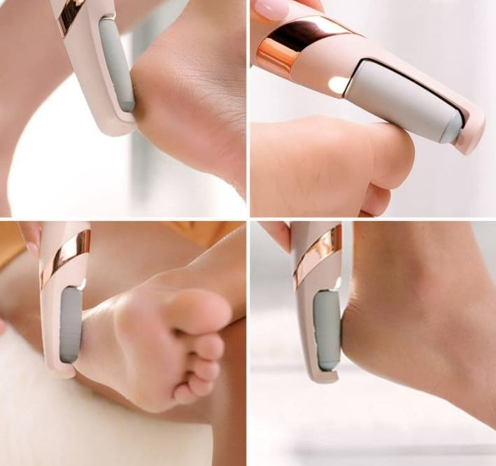 Rechargeable Electric Pedi Foot Filer โ Effective Callus Remover for Soft & Smooth Feet