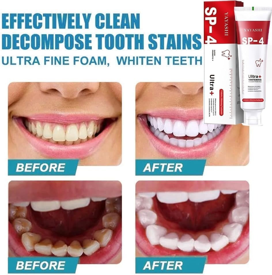 Yayashi SP-4 Ultra Whitening Toothpaste 150 ml